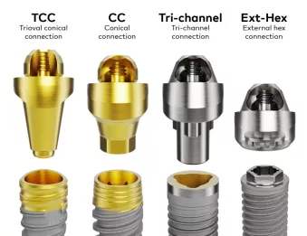 Connections overview