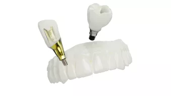 Custom prosthetics
