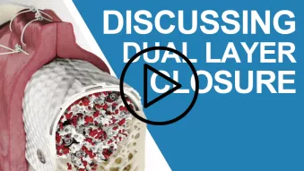 Discussing dual layer closure video