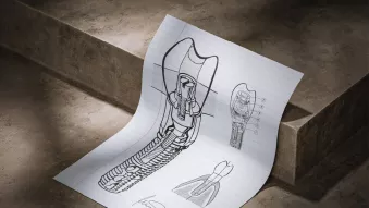 Nobel Biocare implant design
