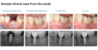 Clinical case sample