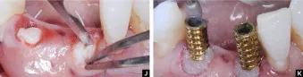 Case courtesy of Dr. Iñaki Gamborena