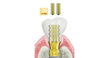 Temporary abutments for base-level restorations