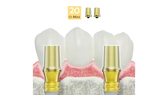 Esthetic abutments