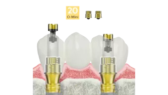 Universal Abutments