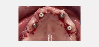 Case courtesy of Dr. Agliardi
