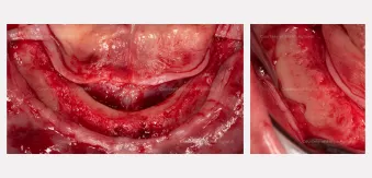 Case courtesy of Dr. Agliardi
