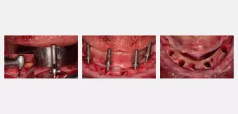 Case courtesy of Dr. Agliardi