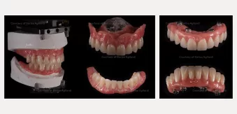 Case courtesy of Dr. Agliardi