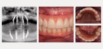 Case courtesy of Dr. Agliardi