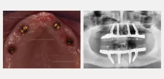 Case courtesy of Dr. Agliardi