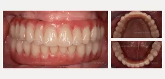 Case courtesy of Dr. Agliardi