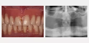 Case courtesy of Dr. Agliardi