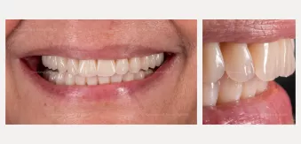 Case courtesy of Dr. Agliardi