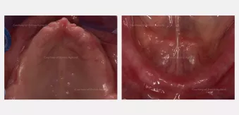 Case courtesy of Dr. Agliardi