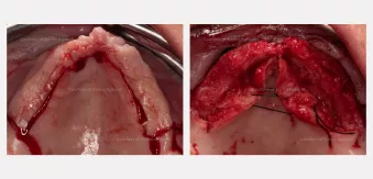 Case courtesy of Dr. Agliardi