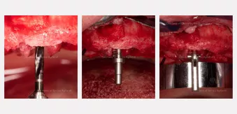 Case courtesy of Dr. Agliardi
