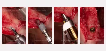Case courtesy of Dr. Agliardi