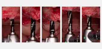 Case courtesy of Dr. Agliardi