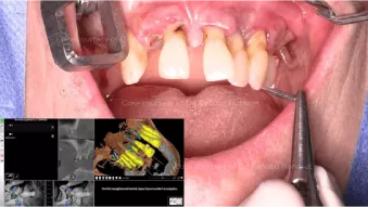 Case courtesy of Dr. Noharet