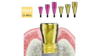 N1 Healing Abutments