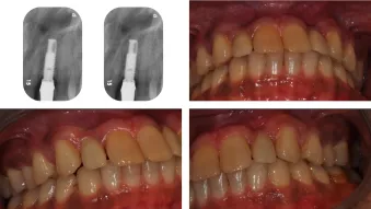 15 years results