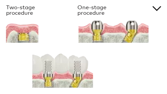 Healing phase and temporization