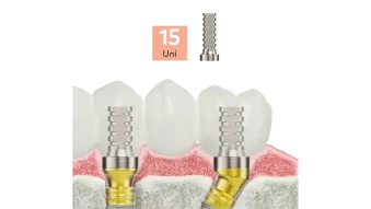 Temporary abutments
