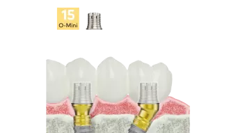Universal Base Non-Engaging Multi-unit Abutment