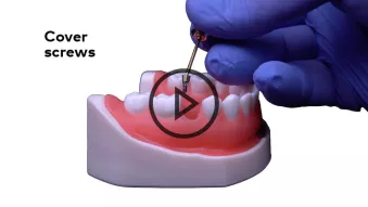 N1 cover screws