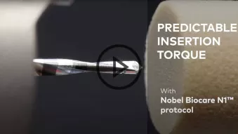 N1  Predictable implant insertion torque