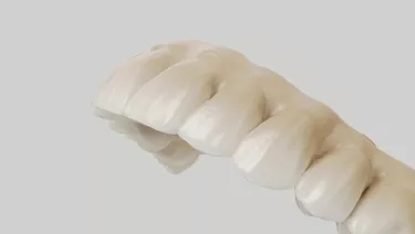 NobelProcera® Esthetic Zirconia Implant Bridge