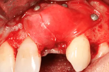 Case courtesy of Dr. Liliana Silva