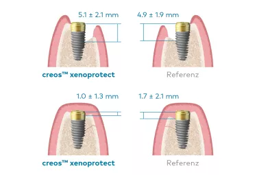 creos xenoprotect trial results