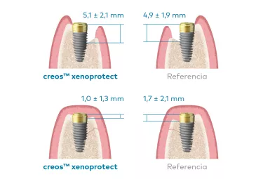 Este esquema muestra la altura del defecto antes del tratamiento y 6 meses después de la ROG