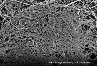 creos xenoprotect SEM image courtesy of Schüpbach