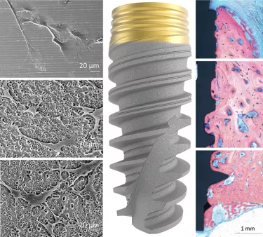 TiUltra human mesenchymal stem cells