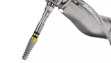 Freehand surgery