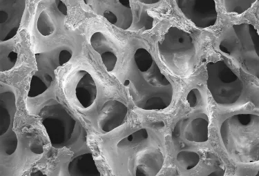 Неорганические губчатые гранулы для костной пластики