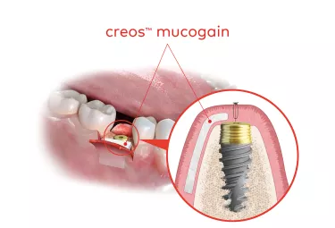 creos mucogain - use straight out of the box