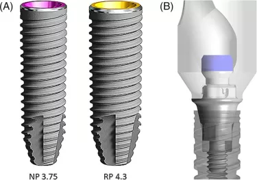 NobelParallel implant