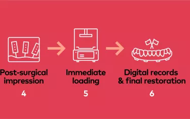 All-on-4® digital workflow