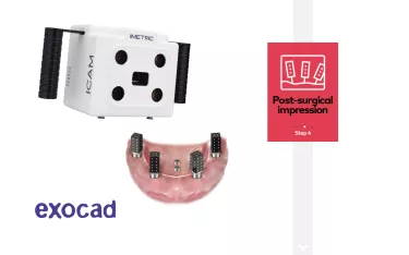 Post-surgical impression