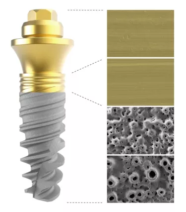 Scanning electron microscopy images of different zones