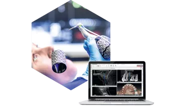 X-Guide with DTX Studio Implant enables the clinician to scan, plan and perform computer-navigated surgery on the same day.