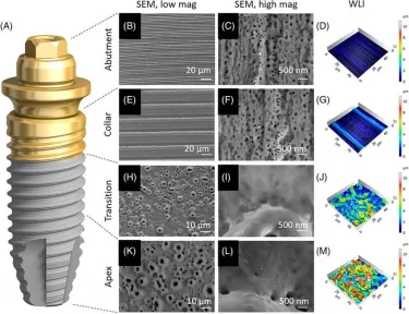 Computer-assisted representation of the implant system depicting the newly engineered surfaces (