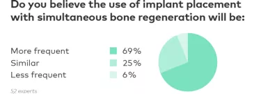 Bone regeneration and implant placement - trend