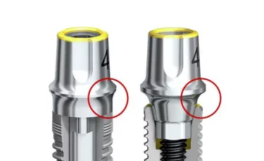 Dental implants without (left) and with (right) platform switching