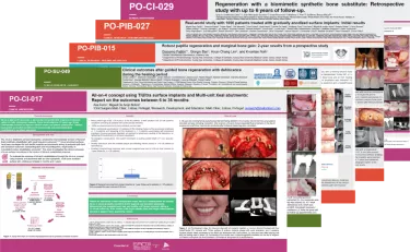 EAO 2023 Nobel Biocare's posters