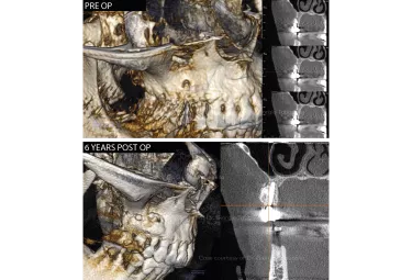 Case courtesy of Dr. Tabanella